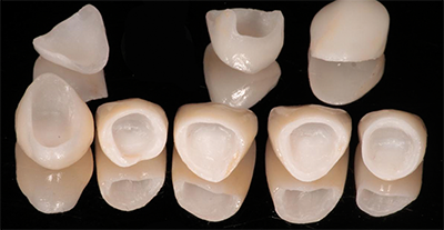 UP DENTAL GRADUATES EXCEL IN PRIVATE PRACTICE