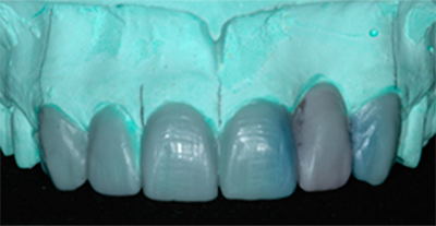 UP DENTAL STUDENTS EXCEL IN COSMETIC DENTISTRY