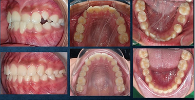 UP Orthodontists Provide Excellent Results!